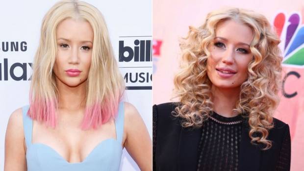 Iggy Azalea ya no pudo esconder sus cirugías en el rostro