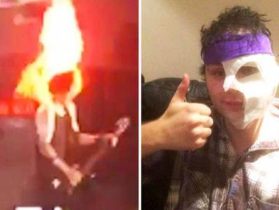 Guitarrista de 5 Seconds To Summer se quemó el rostro en pleno show