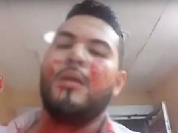 VIDEO: Eduardo, de La Voz México, fue baleado y lo comparte en YouTube