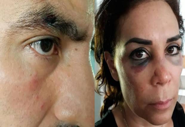 Golpean a candidato del PVEM y a su esposa en Izúcar de Matamoros