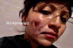 Lucero, la mujer policía quemada por mujeres en la marcha del domingo en CDMX