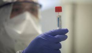4 mil 500 pesos cuesta la prueba de Coronavirus en Puebla
