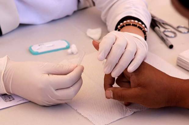 48 casos de SIDA en Puebla durante el primer trimestre de 2019