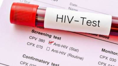 Reportan cura de VIH con células madre