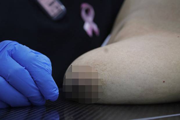 Por detección tardía, 306 poblanas pierden la vida al año por cáncer de mama: Salud