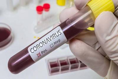 Descifran el genoma del primer caso de coronavirus en América Latina