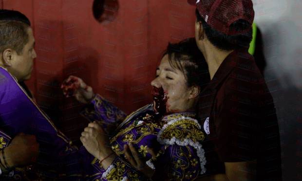 Torera Hilda Tenorio sufre cornada en el rostro en Puebla