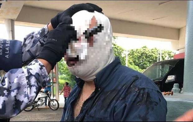Hombre acaba con cuchillo en la cabeza durante pelea en Veracruz