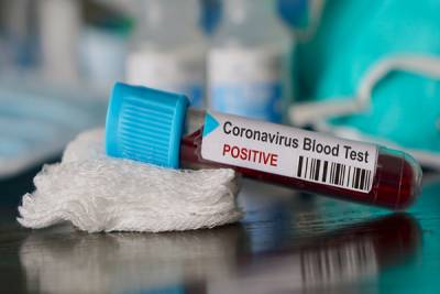 Coronavirus llega a África, confirman primer caso en Egipto