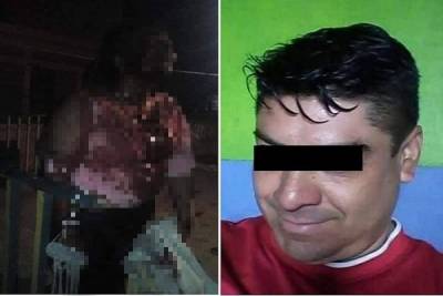 Hermana de uno de los 43 desaparecidos de Ayotzinapa, macheteada por su esposo en Huehuetlán