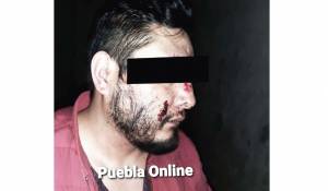 Policías de Coronango, San Martín Texmelucan y Xochitlán lesionan a cuatro detenidos