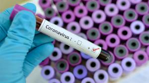 Puebla ya tiene plan y equipo contra coronavirus: Secretaría de Salud