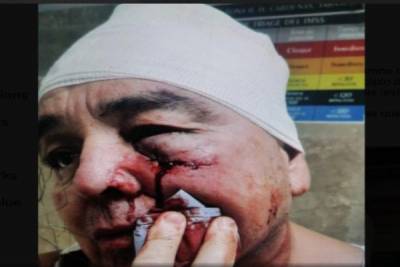 Bachiller atacó a martillazos a su profesor en Tabasco