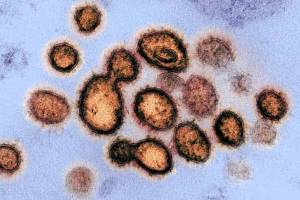 Coronavirus: lavabos e inodoros, principales fuentes de contagio