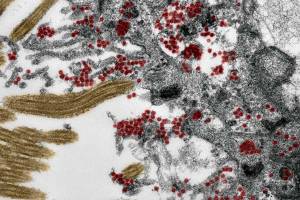 El coronavirus se cuela en el cerebro por la nariz, revela estudio