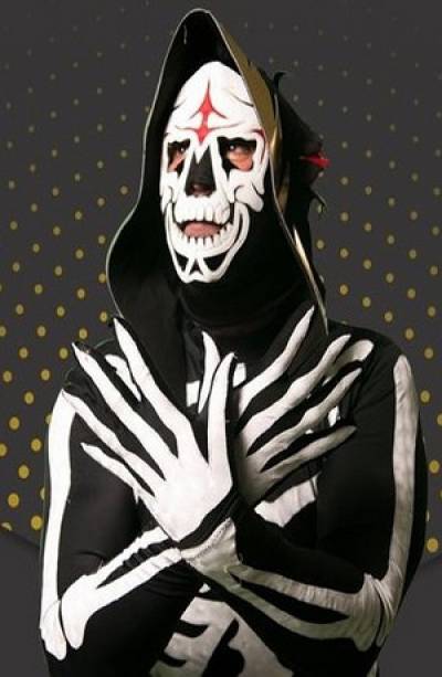 La Parka sigue estable pero aun no reacciona tras operación