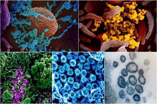 Así es el coronavirus bajo el microscopio