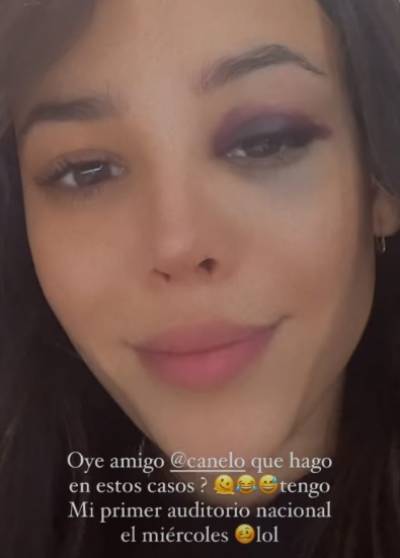 Danna Paola pide &quot;ayuda&quot; al Canelo para tratar golpe en el ojo