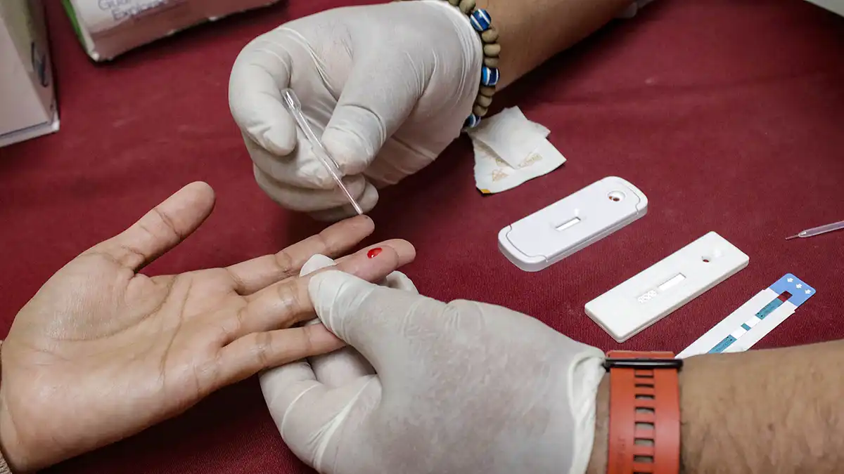 Cada 3 días murió un paciente con VIH en Puebla: SSEP